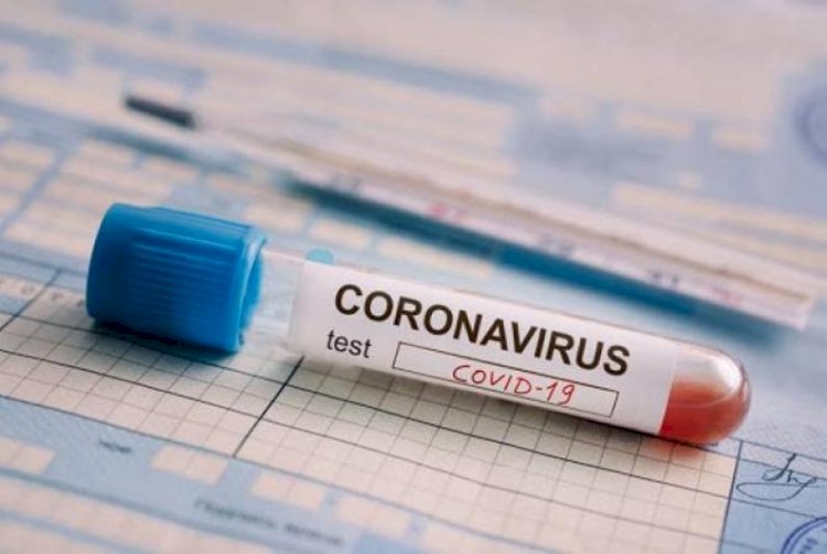 Қазақстанда өткен тәулікте 2252 адамнан коронавирус анықталды