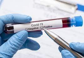 1 058 адам коронавирус инфекциясын жұқтырған