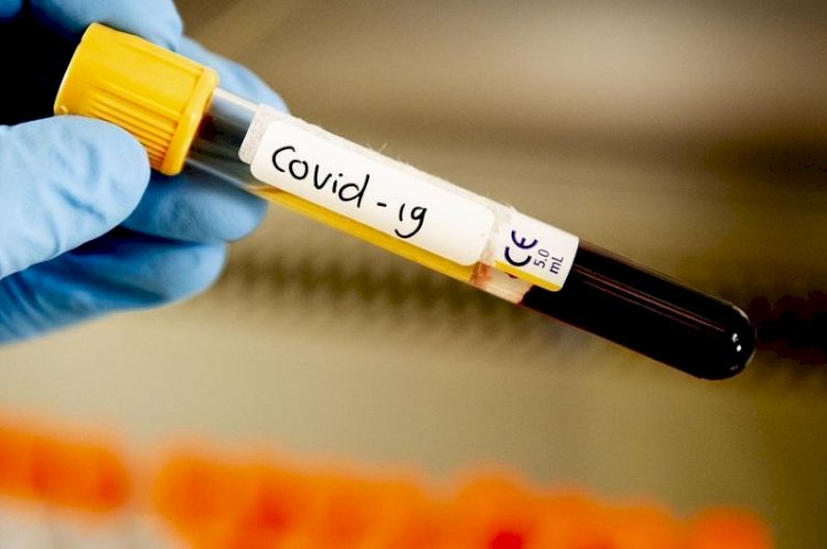 Қазақстанда ПТР арқылы 480 адамның коронавируспен ауырғаны расталды