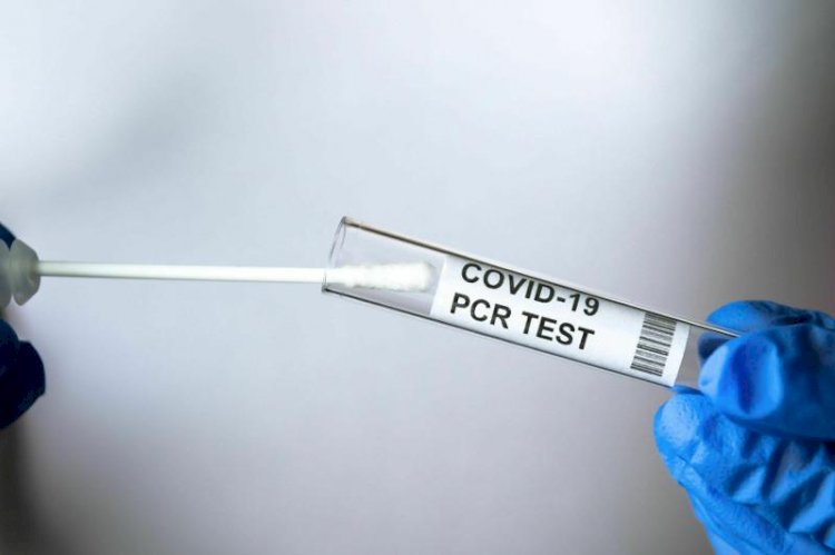 Өткен тәулікте Алматыда 24 адамнан коронавирус инфекциясы анықталды