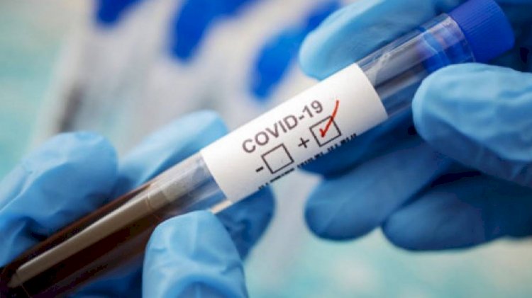 Өткен тәулікте 95 адамнан коронавирус анықталды