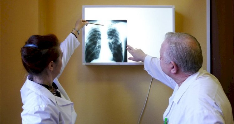 Қазақстанда туберкулезбен науқастану деңгейі  24%-ға төмендеді – Алматы сарапшылары